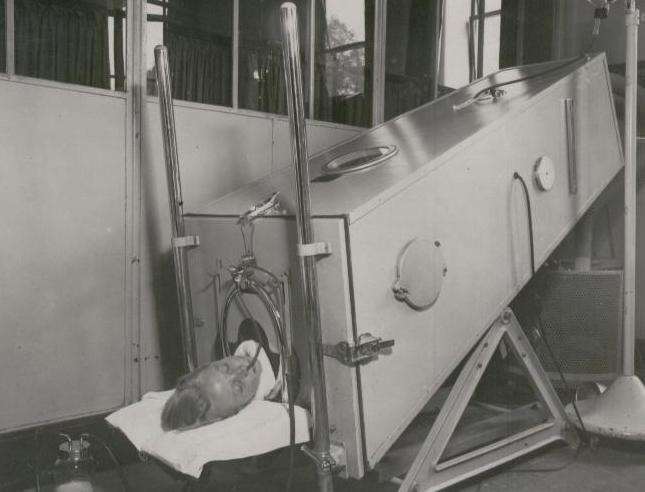 A patient inside an iron lung at Kent & Sussex Hospital in the 1950s during the polio epidemic