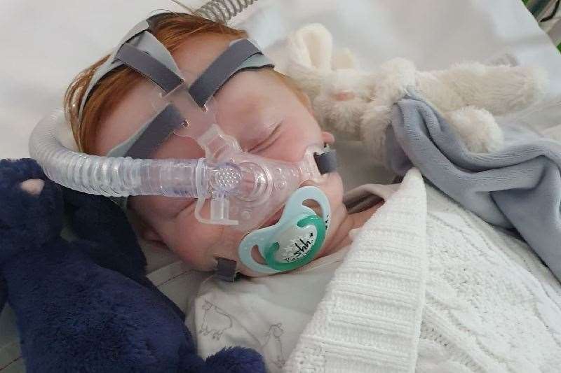 Harry sleeping with his ventilator