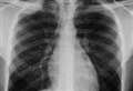 IT failure caused huge x-ray backlog