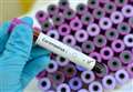 Surgery closes in coronavirus alert