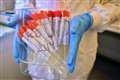 Belfast researchers lead UK-wide coronavirus clinical trial