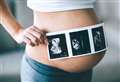 Trust to charge parents for baby scan photos