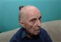 Pensioner's head growth surgery cancelled