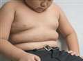 Childhood obesity a 'serious challenge'