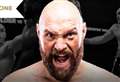 Tyson Fury to appear at hotel 