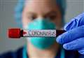 Rise in confirmed coronavirus cases