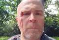 Road rage attacker punches dad in front of daughters