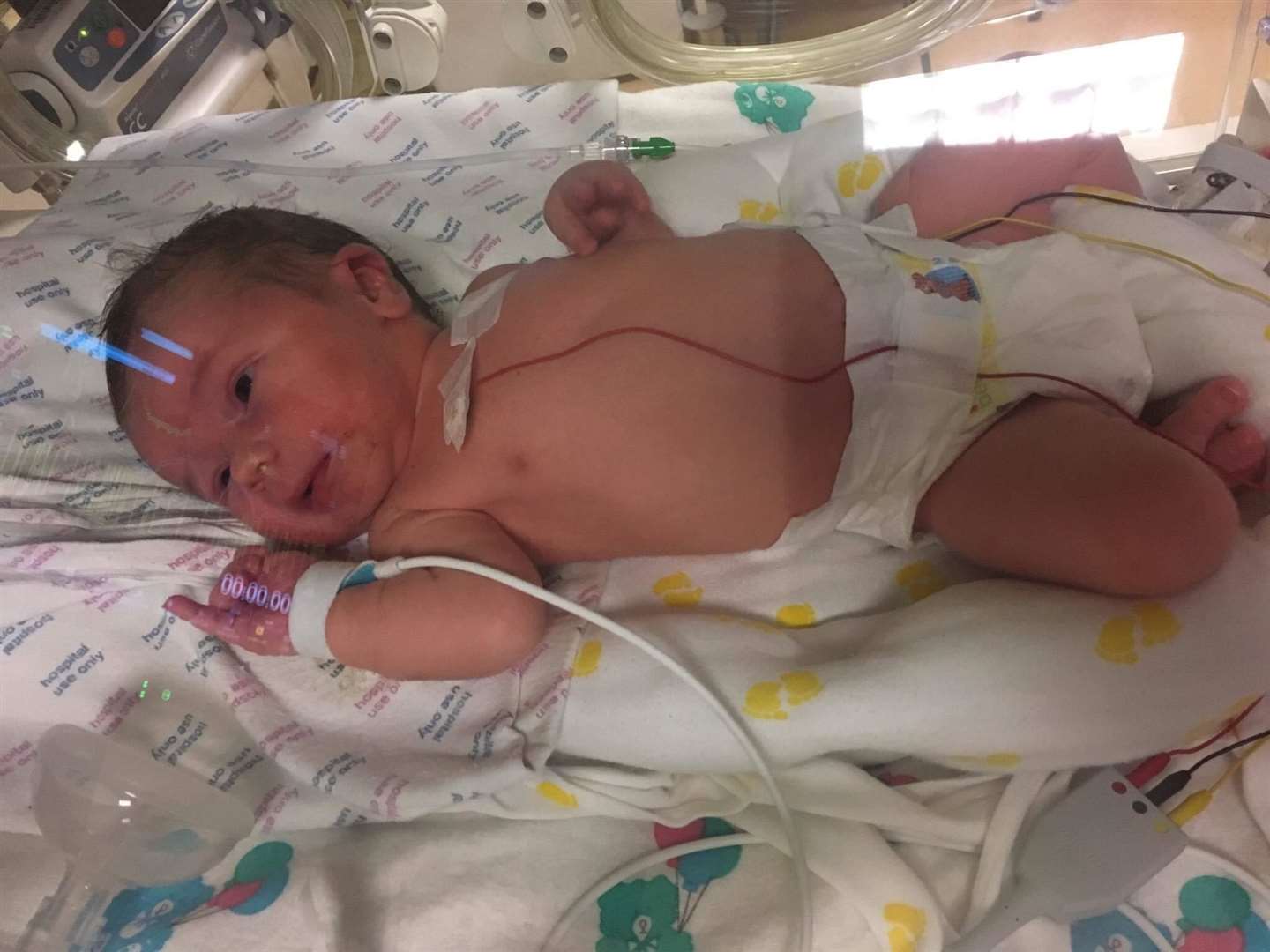 Baby Ollie in his incubator. Picture: Martin Roby