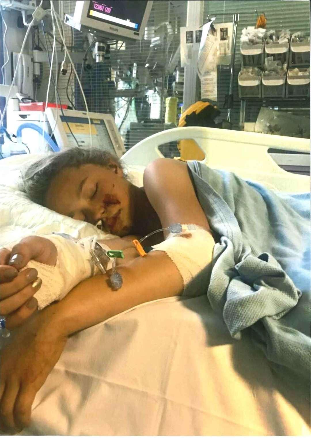 Gracie Maddox at King's hospital on life support following a tragic accident on Fleet Estate, Dartford on June 26, 2017.