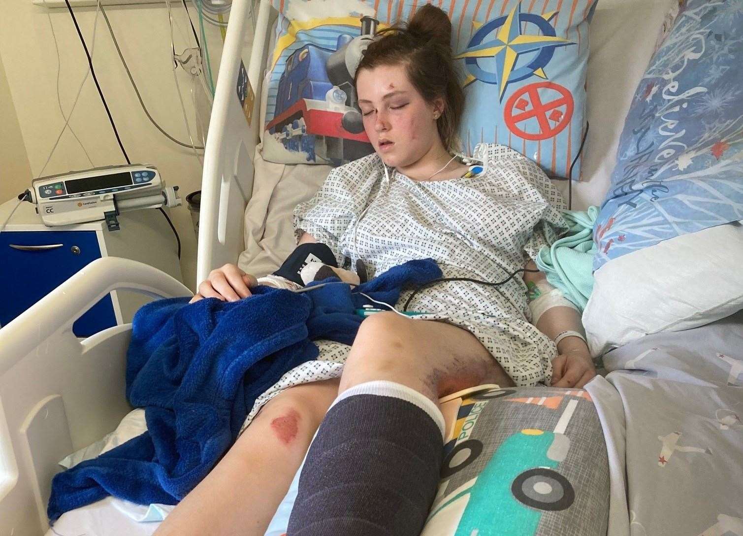 Maya McFadden, 11, was badly injured after being hit by a car on Canterbury Road in Densole, near Folkestone, when crossing the road from the bus stop. Picture: Sean McFadden