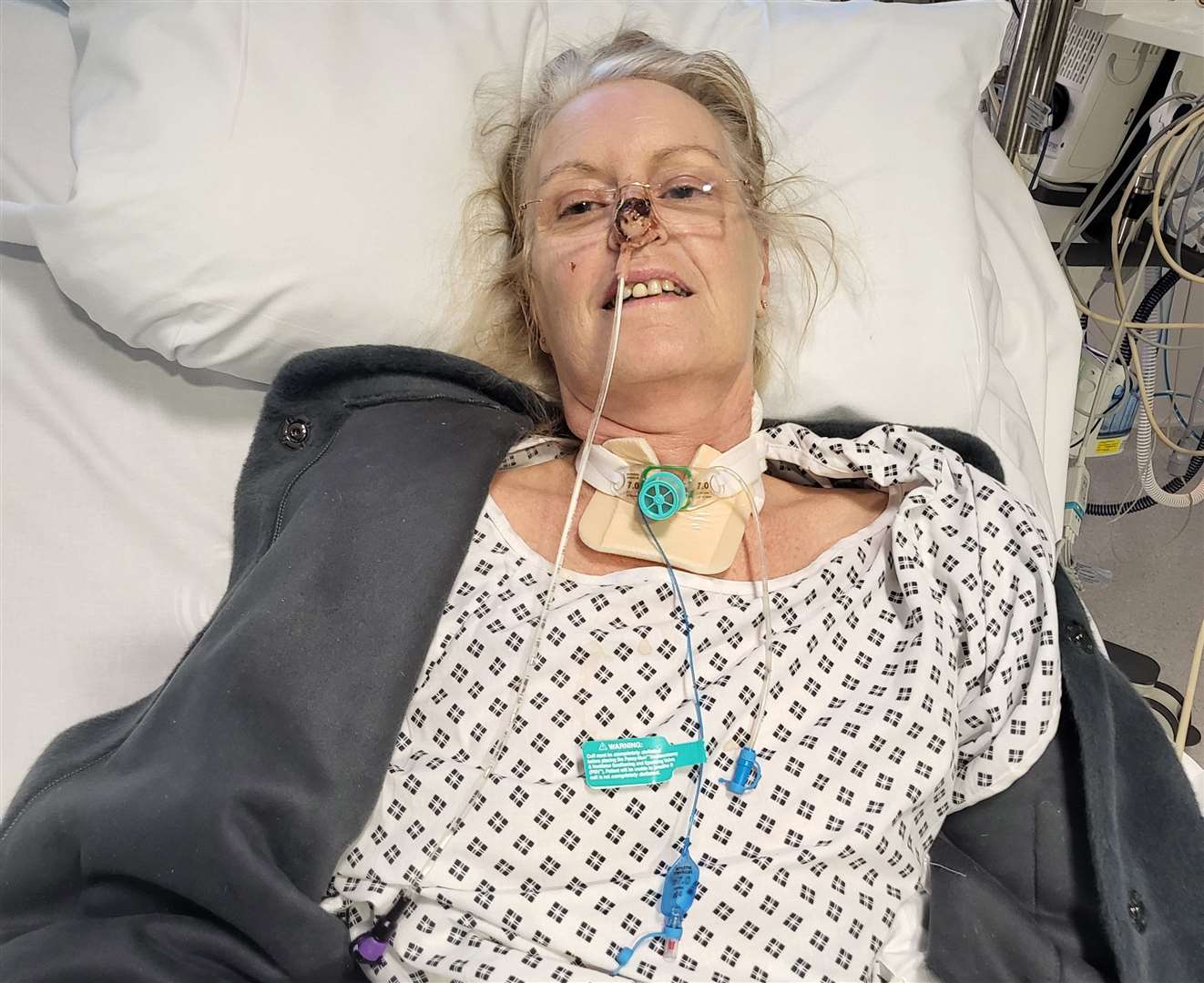 The 60-year-old went into septic shock. Picture: SWNS