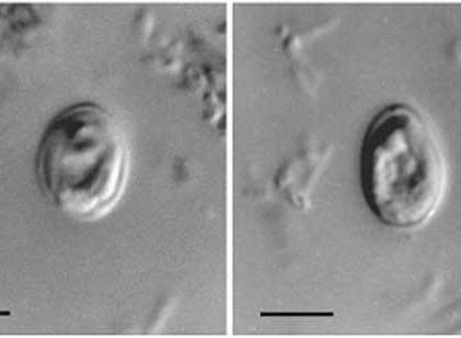 The cryptosporidium parasite under a microscope