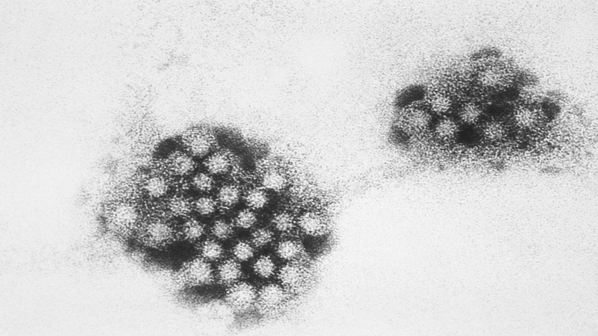 Transmission electron micrograph of Norovirus