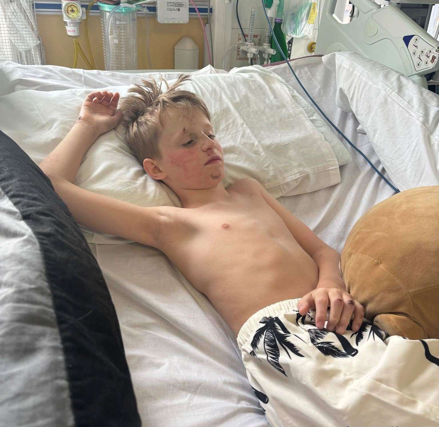 Harrison was treated at King’s College Hospital in London