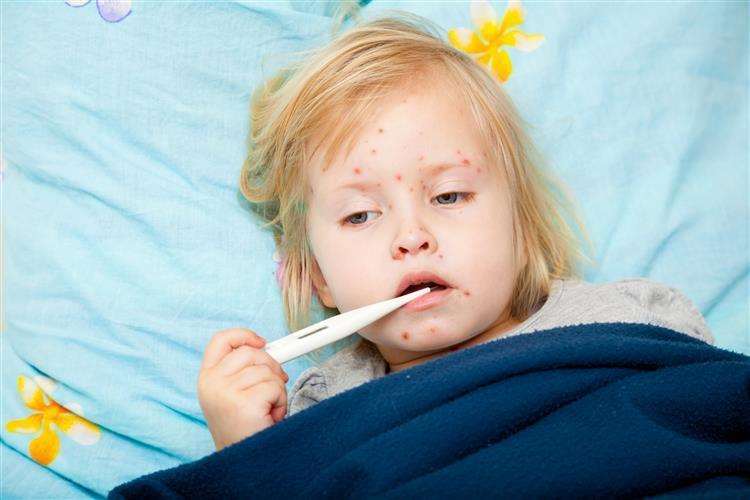 A measles victim - Thinkstock (1442177)