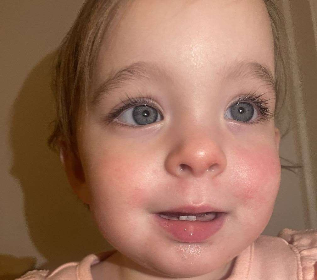 Sarah's daughter, Mia, had symptoms of scarlet fever. Picture: Sarah Zahra