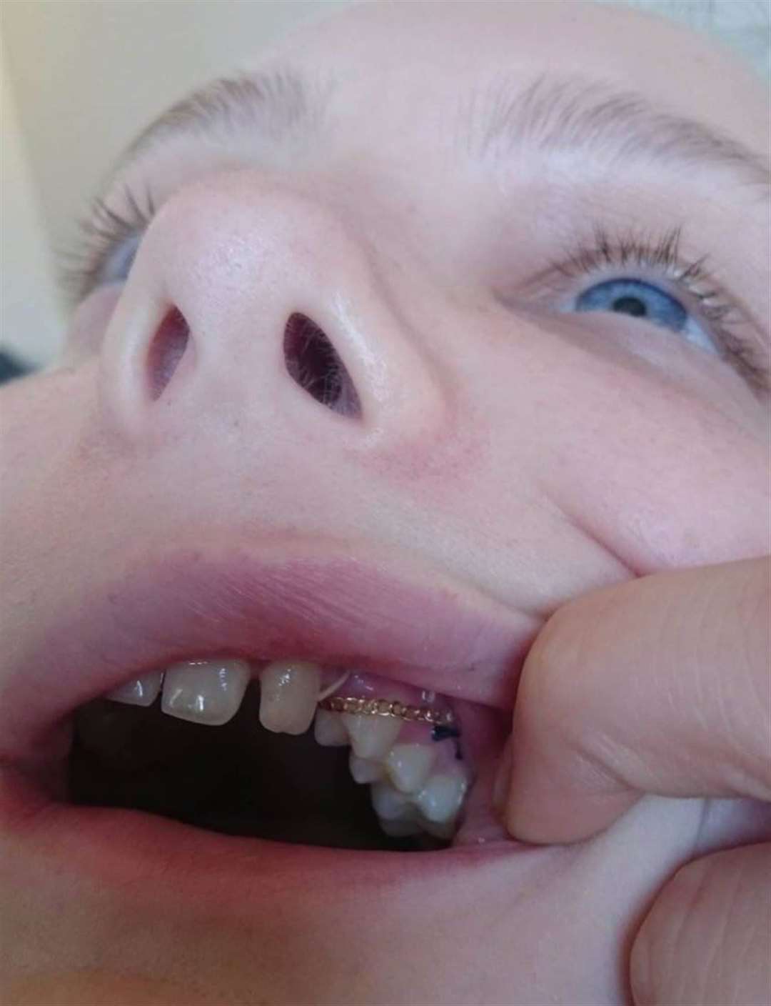 The student's remedial work involved a chain being put in her mouth. Picture: SWNS