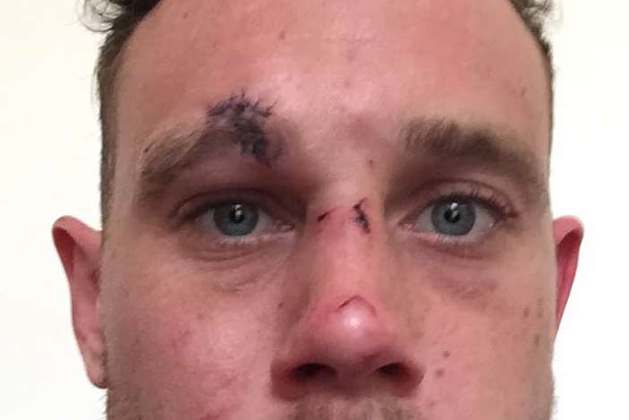 Joshua Buggins was attacked in the Dane John Gardens