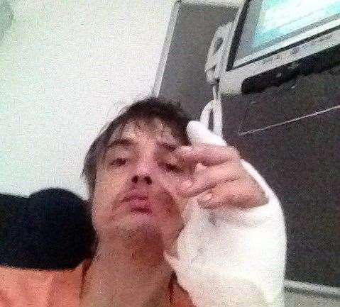 The Libertines frontman shared photos of himself in hospital in Manchester while on tour. Picture: Pete Doherty/Twitter