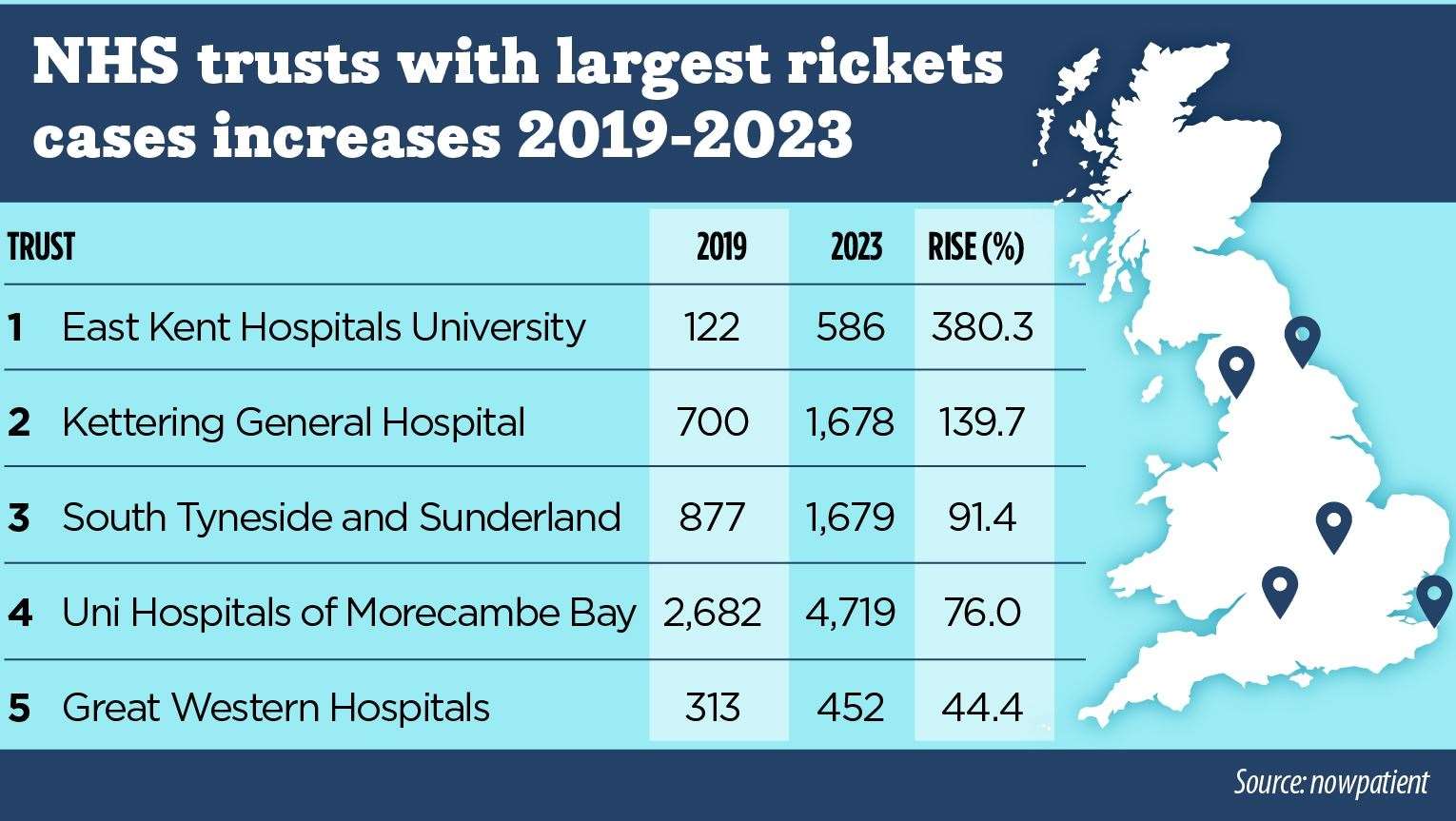 East Kent hospitals recorded a 380% increase in rickets cases between 2019 and 2023