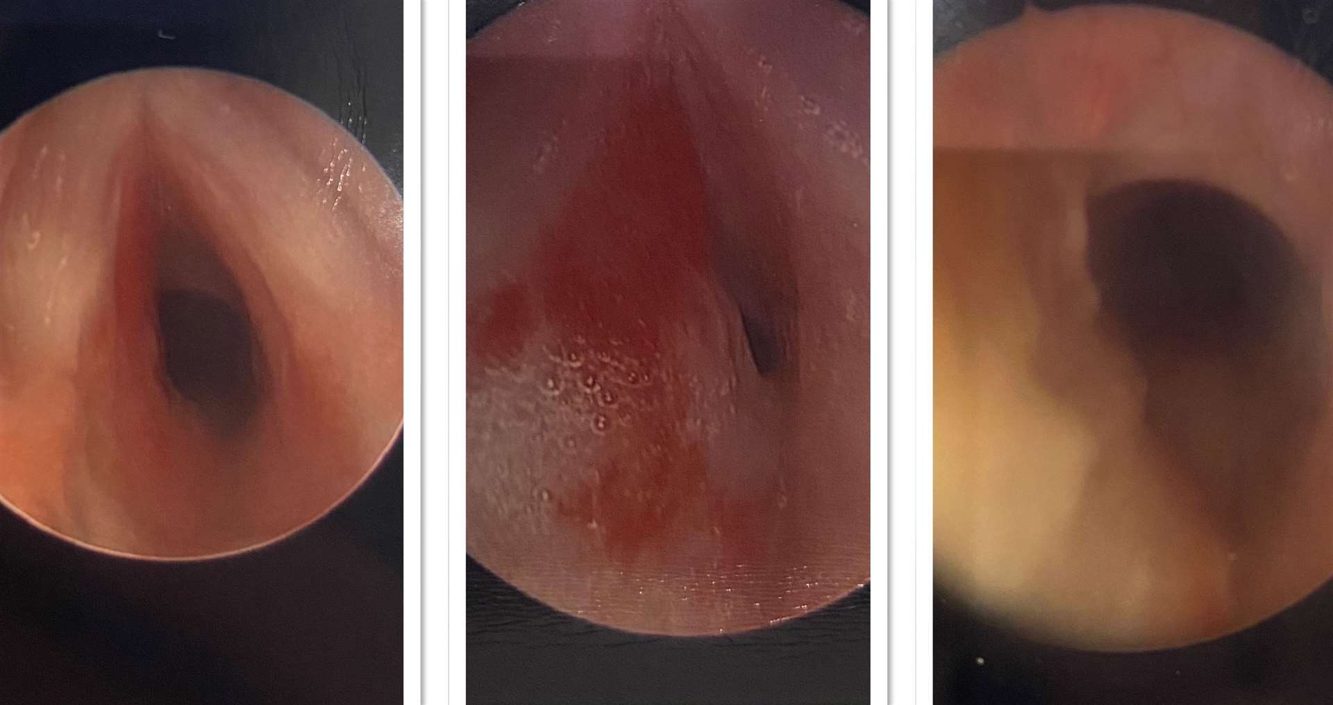 Inside Mia's airways in May, September and October