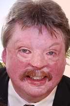 SIMON WESTON: aboard the Sir Galahad when she was bombed in 1982