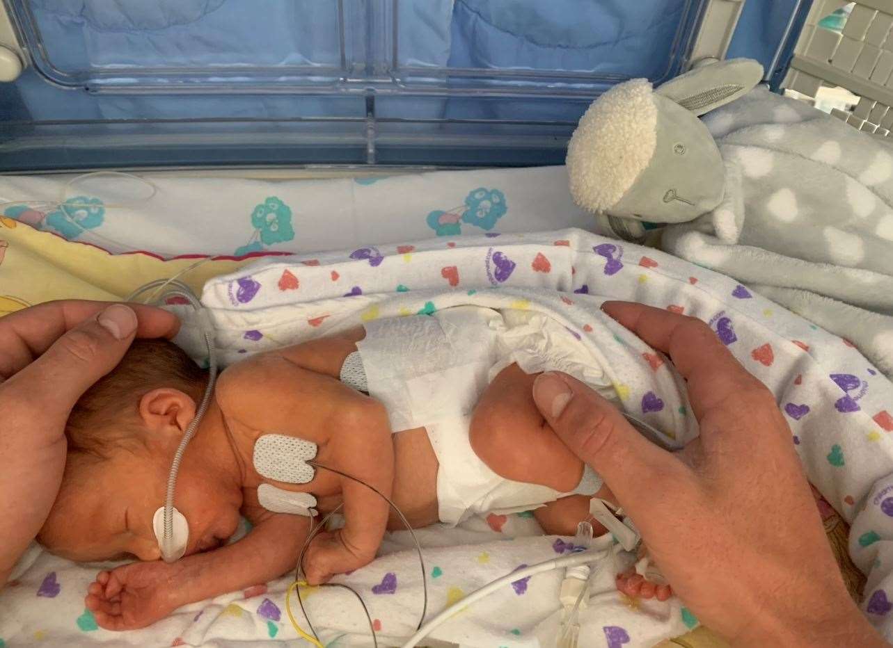 Baby Gracie in the NICU at William Harvey Hospital in Ashford