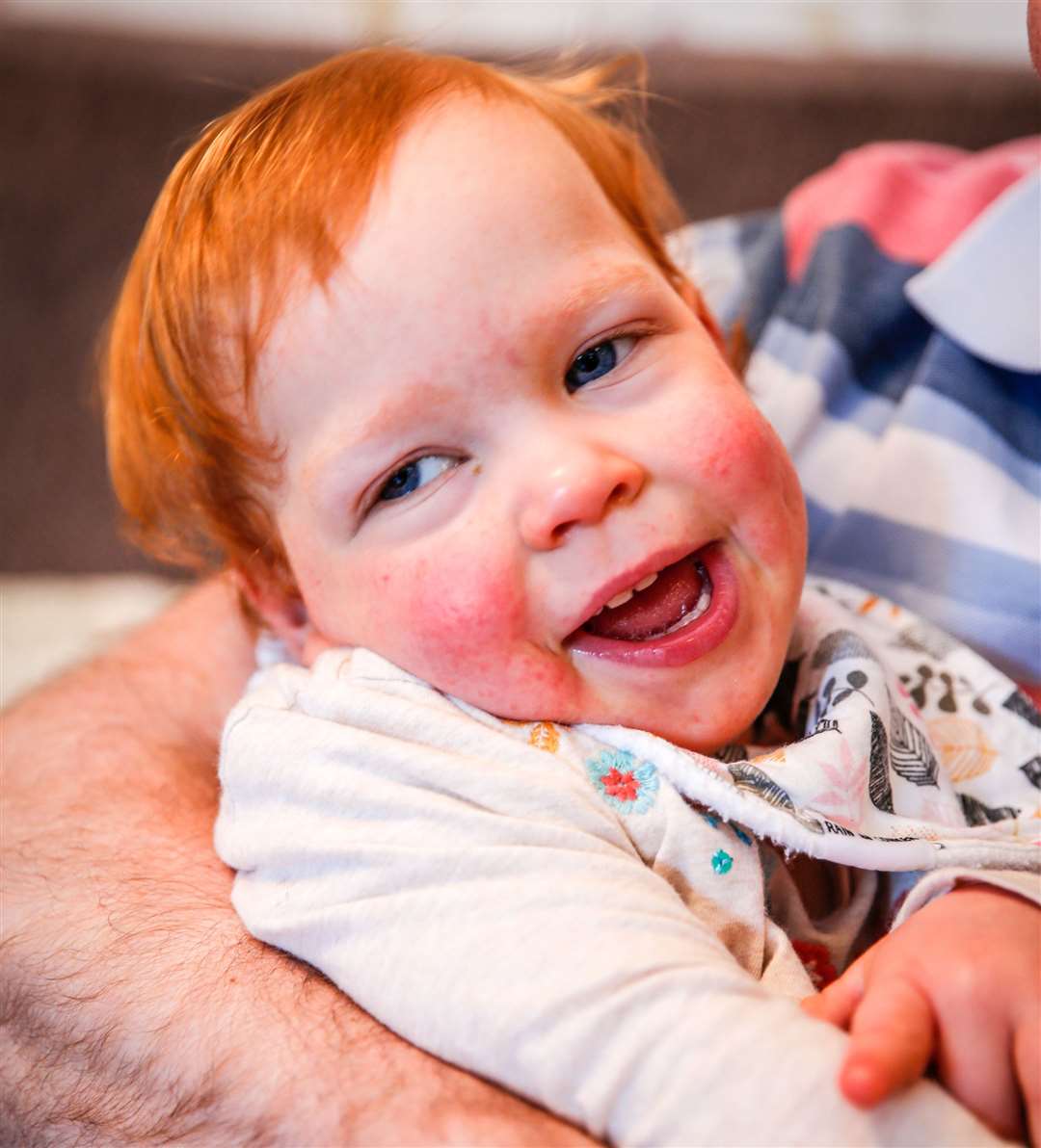 Evie , 2, who had a stroke in the womb. Picture: Matthew Walker