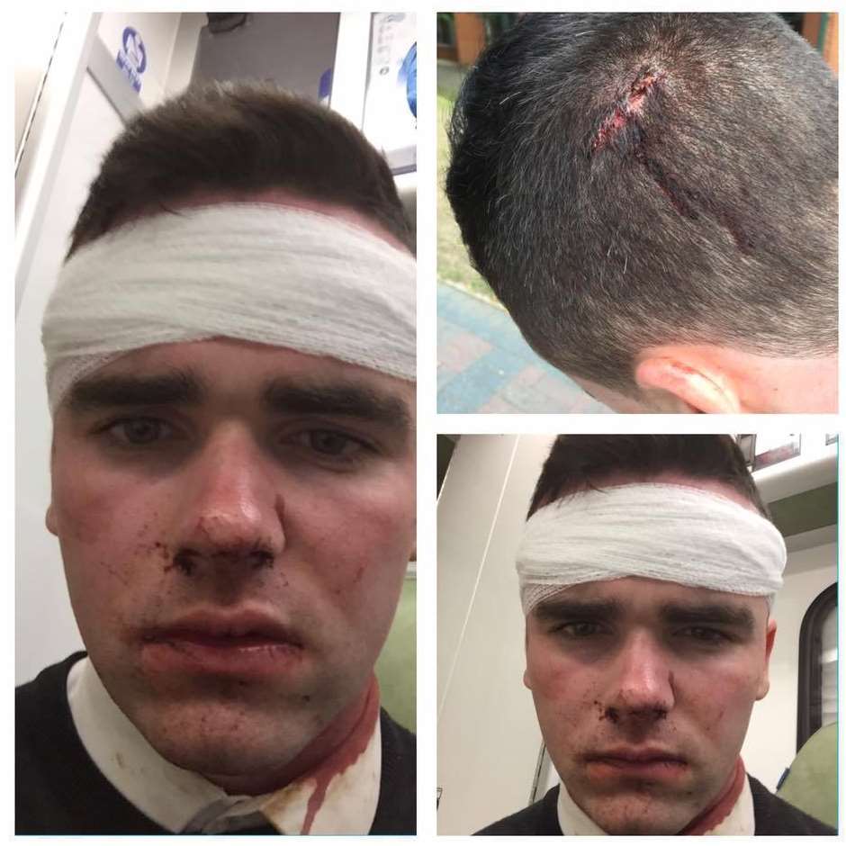 Ryan Sadler, 19, was attacked at McDonalds in Strood